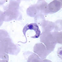  detect trypomastigotes  project thumbnail