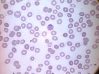 Plasmodium Vivax project thumbnail