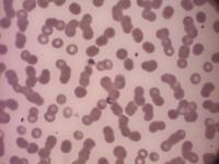 Plasmodium Malariae project thumbnail