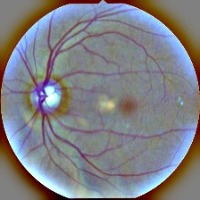 Fundus project thumbnail