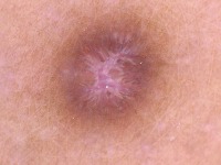 skin disease project thumbnail