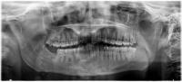 dental_ai project thumbnail