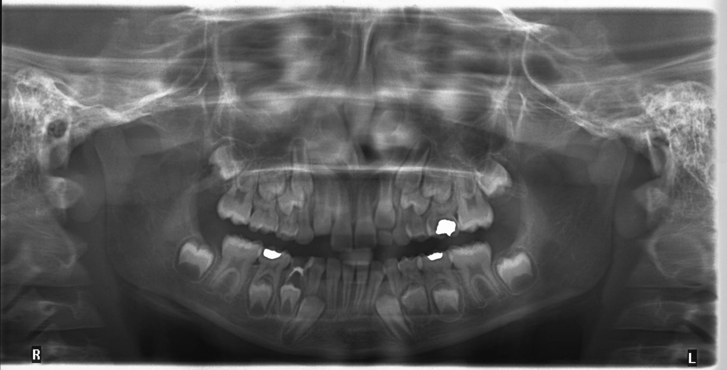 Siced Instance Segmentation Dataset And Pre-trained Model By Dientes