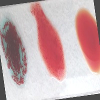 ABO blood group Object Detection Model by ABO Blood Grouping