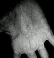 vein rec project thumbnail