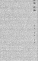 Xray-pcb-detection project thumbnail