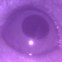 select eye pupil project thumbnail
