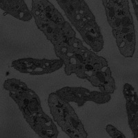 Instance Segmentation project thumbnail