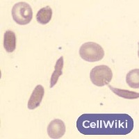 dataset project thumbnail