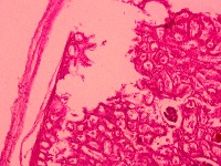 MRI project thumbnail