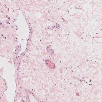 All rectal biopsy project thumbnail