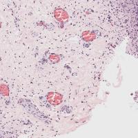 Nerve Segmentation project thumbnail