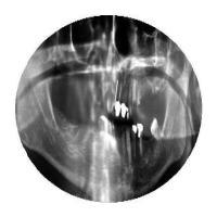 orgina+augmentation project thumbnail