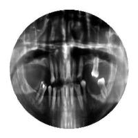 orignal dataset project thumbnail