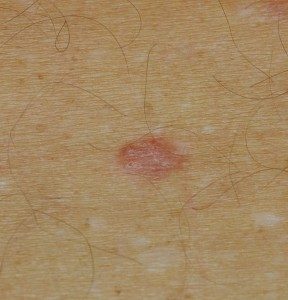 Trigger Pattern Skin skin Object Detection Model by project-niaz0