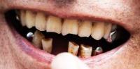 oral-diseases 2 project thumbnail