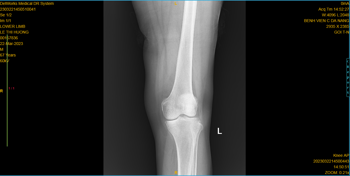 Knee ROI Identification Object Detection Dataset by GSOFT