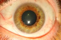 iris project thumbnail