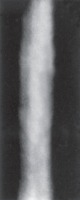 X-ray Weld Defect project thumbnail