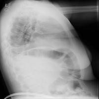nih-xray-sbyy project thumbnail