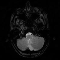 mri project thumbnail