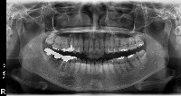 TeethStatus project thumbnail