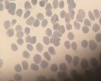 Malaria 2 project thumbnail