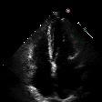 Echocardiac project thumbnail
