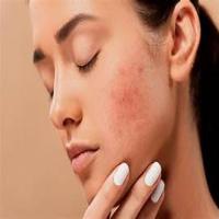 skin problem project thumbnail