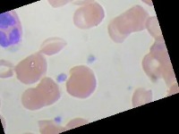 Blood Cells Classification Dataset by National Changhua University of ...