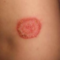 saa.derma project thumbnail
