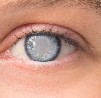 eye project thumbnail