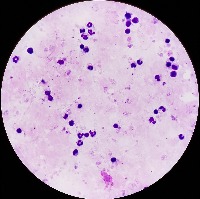malaria project thumbnail