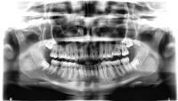 ImageContrastSegmentation project thumbnail