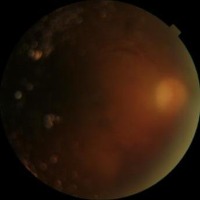 MACHINE TOPCON project thumbnail