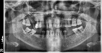 DD project thumbnail
