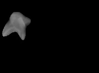 Decidous_Molars project thumbnail