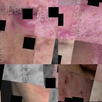 Dataset Image
