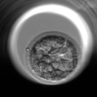 oocyte_prediction_train project thumbnail