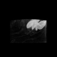 dürdane dönmez sagittal project thumbnail