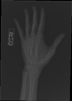x-ray rheumatology project thumbnail