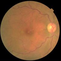 eye project thumbnail