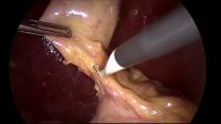 surgery annotation project thumbnail