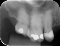 Radiografias project thumbnail