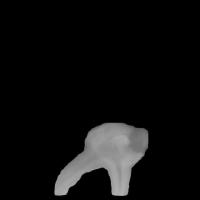 Caries_3sep_MRDT project thumbnail