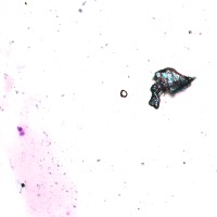 102322_malig_norm project thumbnail