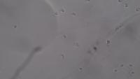 pol project thumbnail