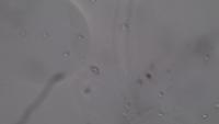 urine project thumbnail