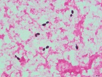 blood_slices project thumbnail