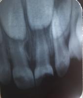 PA X-rays project thumbnail